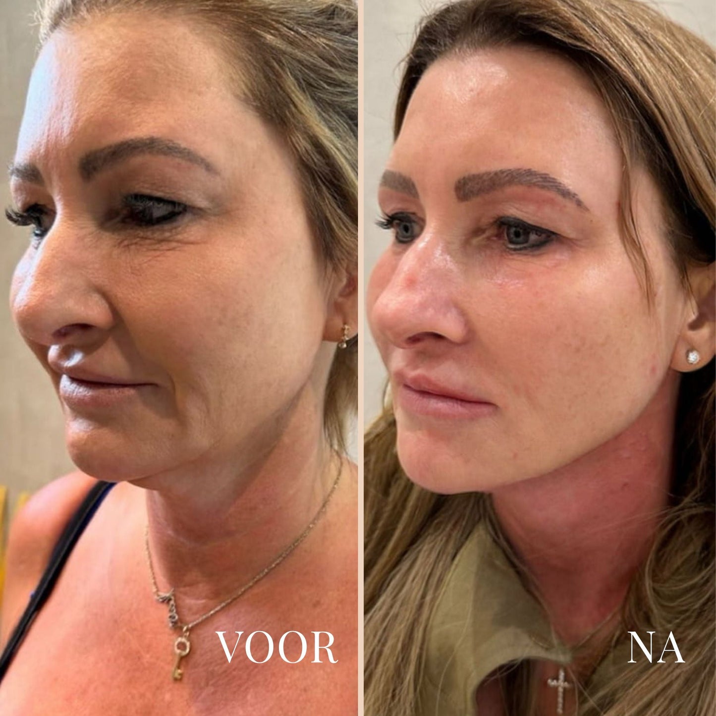 LinaLift Nek en Oog Versterker Creme