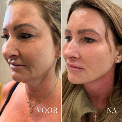 LinaLift Nek en Oog Versterker Creme