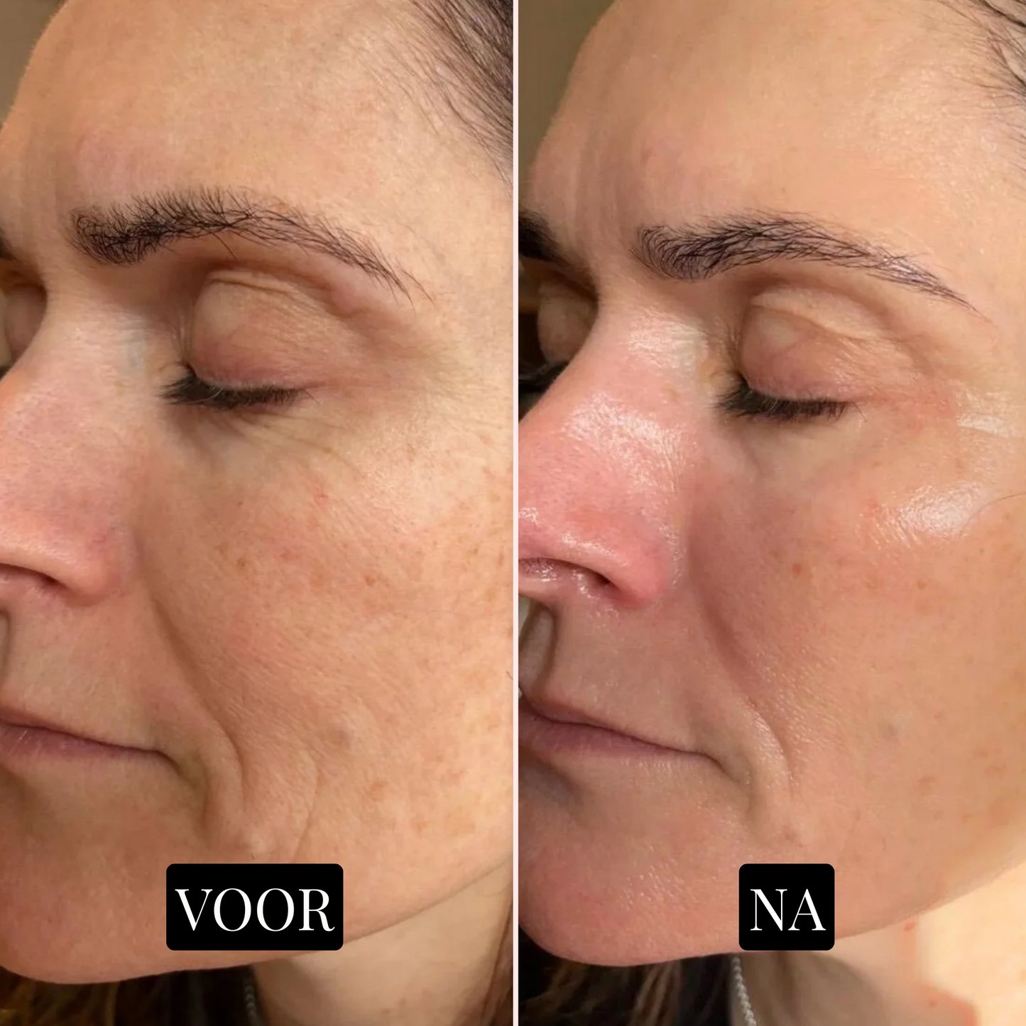 GlowNest Collageenmasker