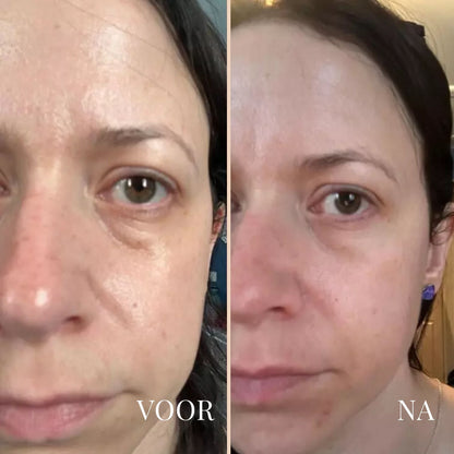 LinaLift Nek en Oog Versterker Creme