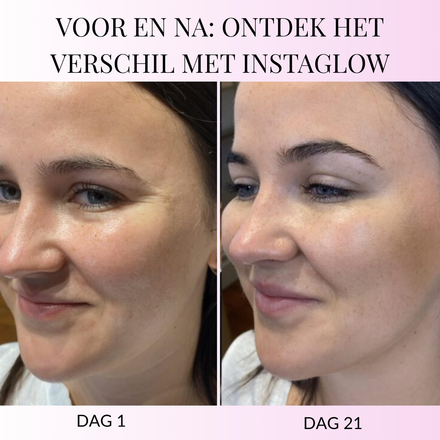 InstantEye Ontwakingscrème