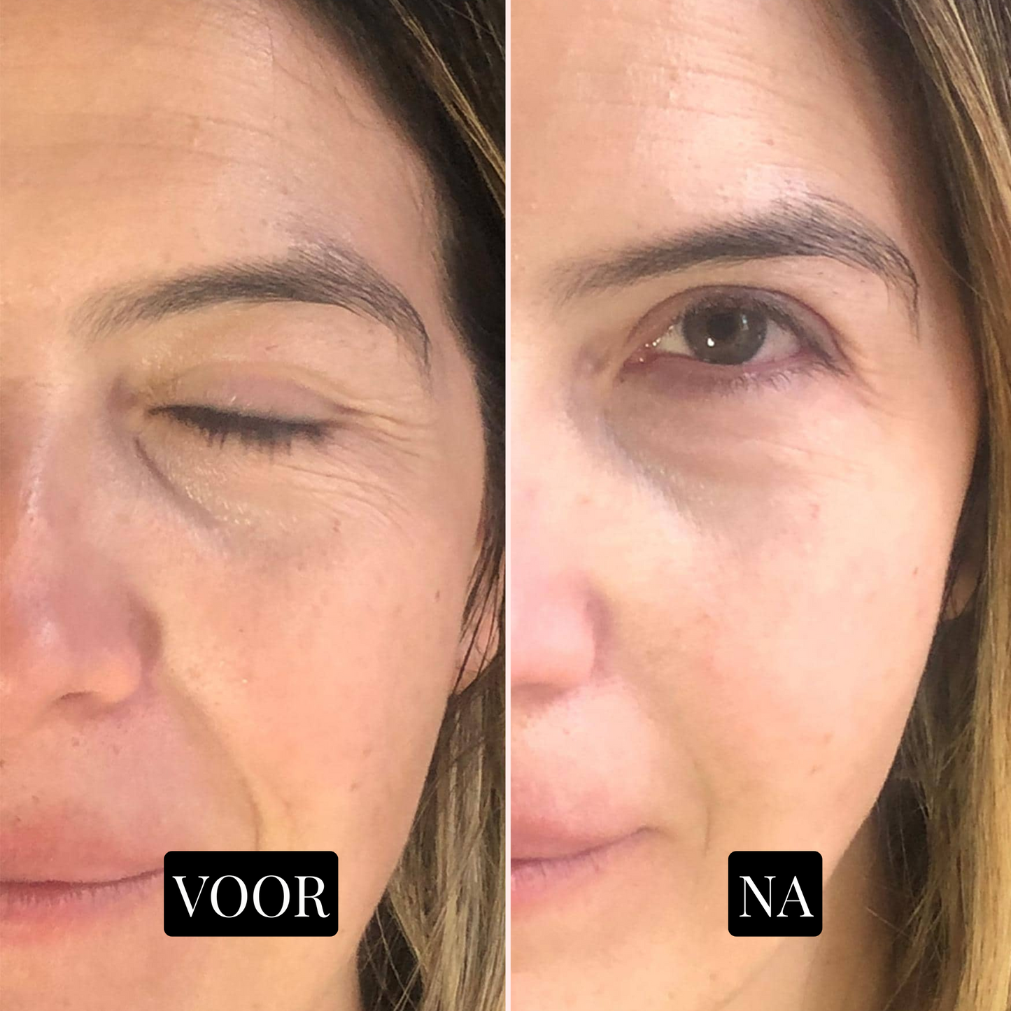 GlowNest Collageenmasker