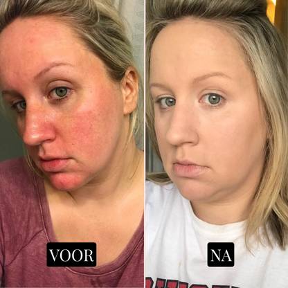 GlowNest Collageenmasker