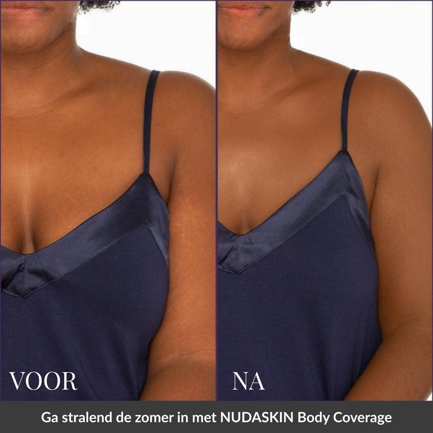 Nudaskin Body Coverage Concealer