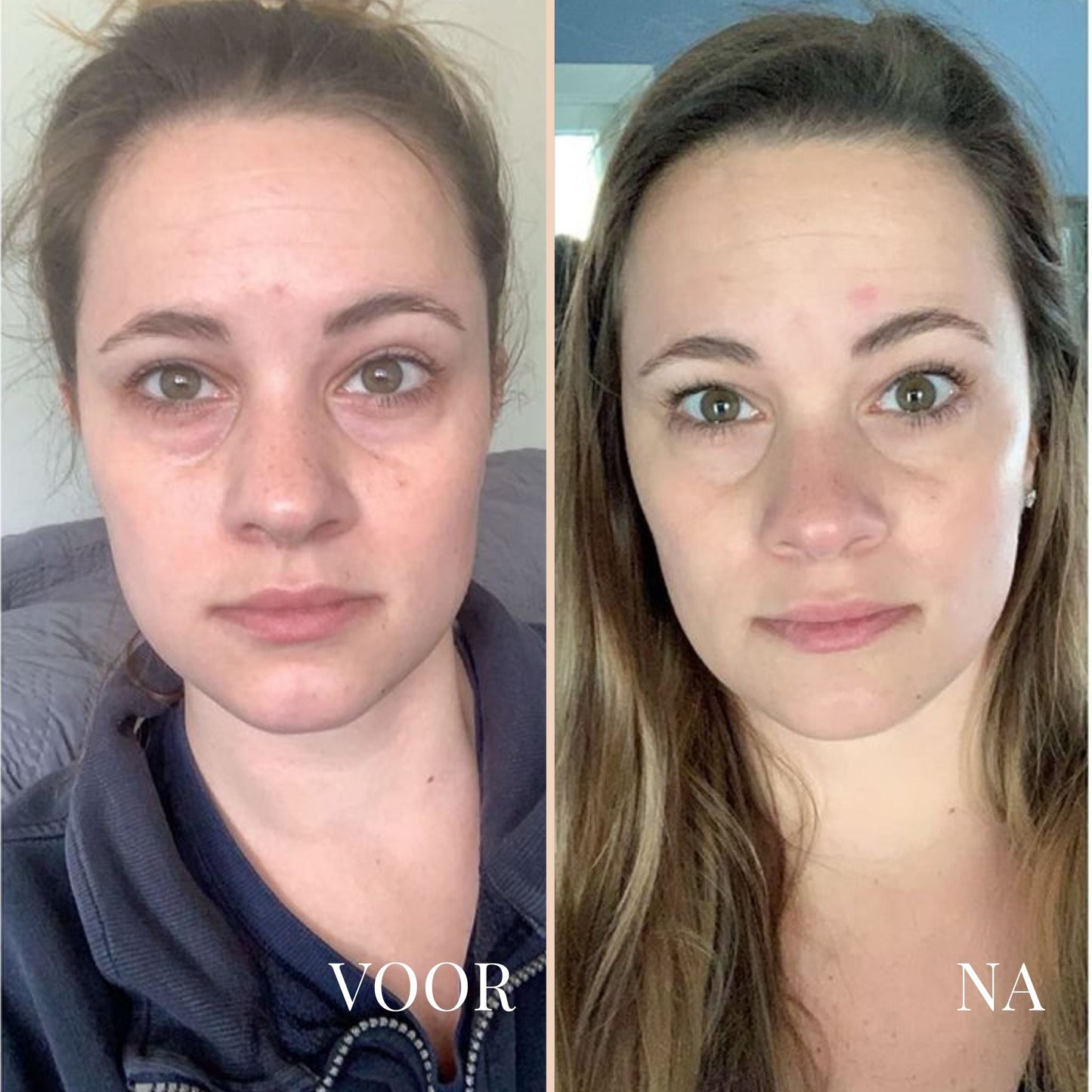 LinaLift Nek en Oog Versterker Creme