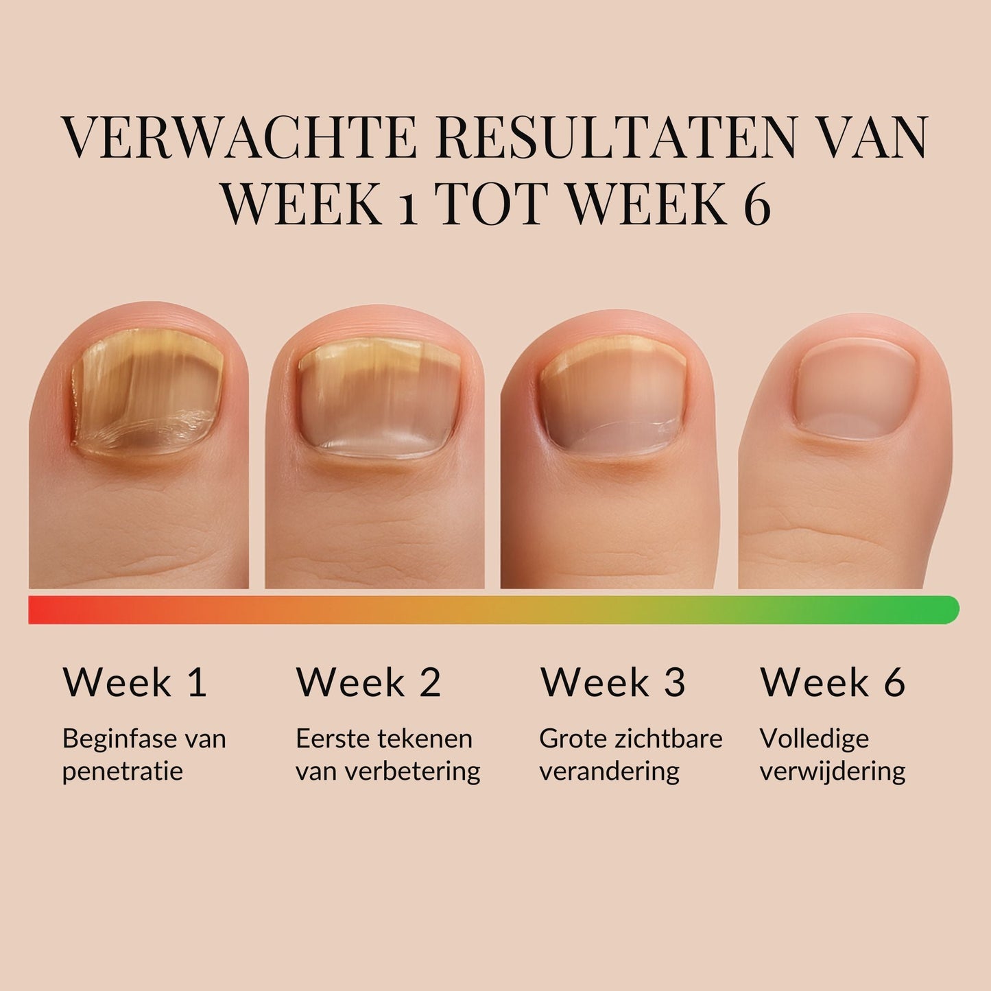 ReviveNail Pleisters | Tegen Kalk- En Schimmelnagels